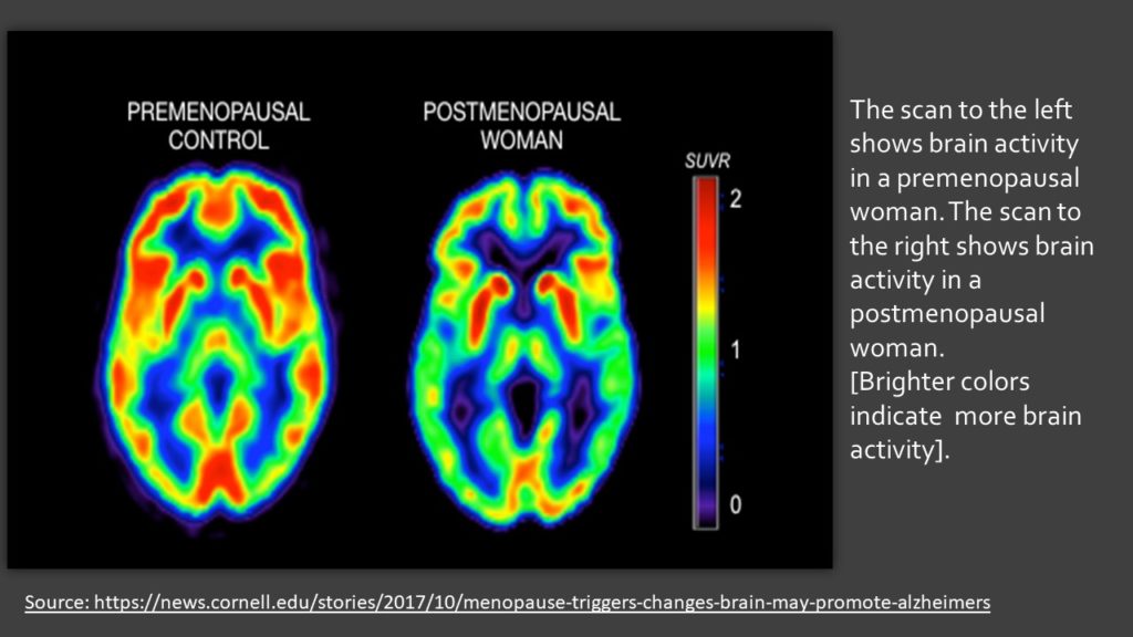 Feeling Why your brainfog baffles you in menopause. My