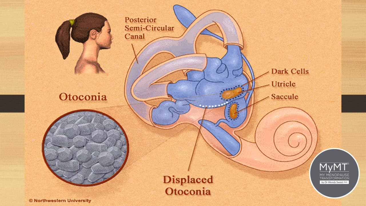 Have you got that dizzy feeling now that you're in menopause? My