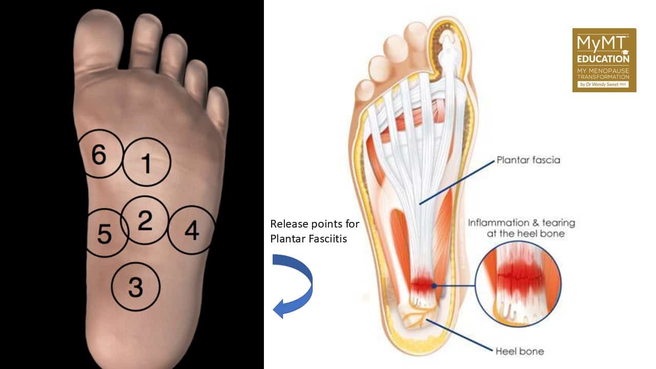 Illustration of base of foot showing the cause of menopause and sore feet