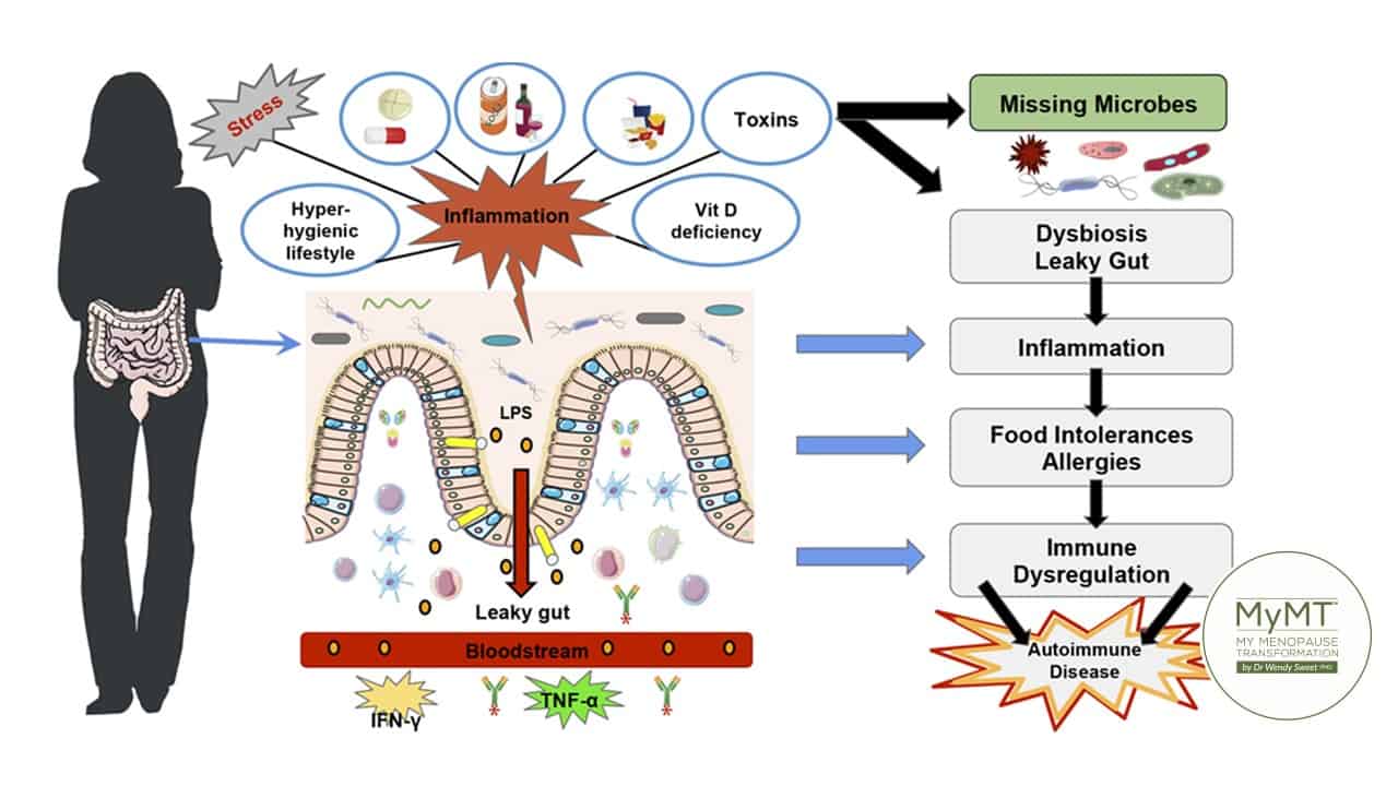 Diagram showing the link between vitamin D and menopause, gut dysbiosis, leaky gut, inflammation and autoimmune disease.